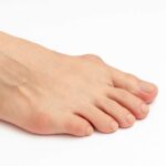 Haluksy – kompleksowy przewodnik po objawach, przyczynach i metodach leczenia